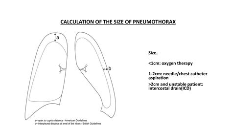 Pneumothorax | PPTX