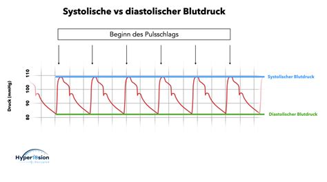 Hypertonie einfach erklärt - hyper10sion.com