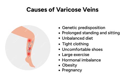 Premium Vector | Causes of varicose veins medical information