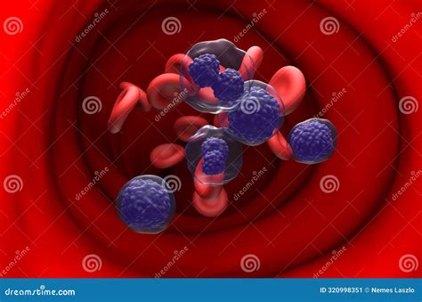 Plasma Cell Leukemia (PCL) - Section View 3d Illustration Stock ...