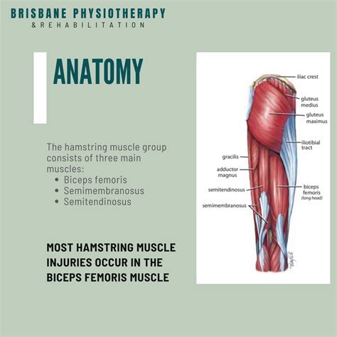 Hamstring Injury Diagram