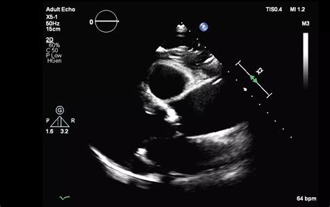Affiniti CVx Cardiac Ultrasound