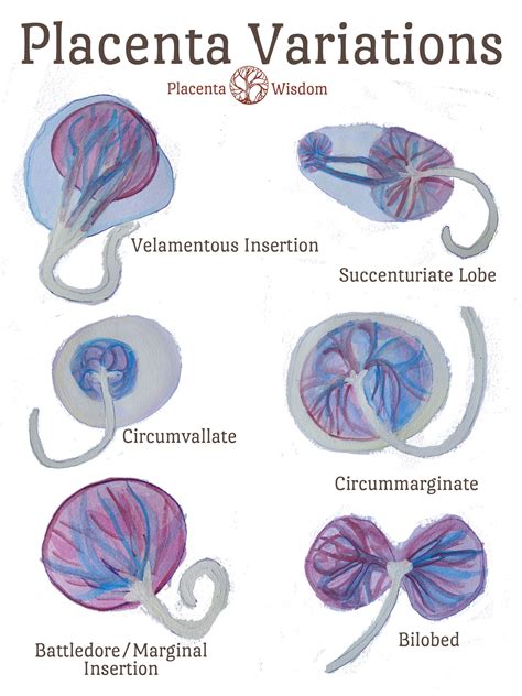 Types Of Placental Cord Insertion at Harold Chappell blog
