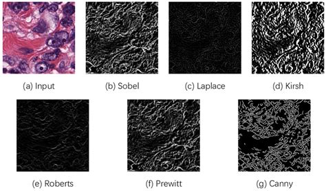 Edge-Guided Cell Segmentation on Small Datasets Using an Attention ...