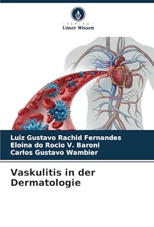 Buy Vaskulitis in der Dermatologie Book Online at Low Prices in India ...