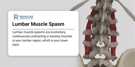 Lower Back Muscle Spasm 的图像结果