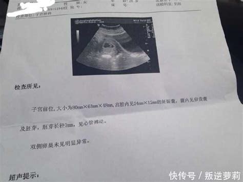 孕检报告单上这些数字, 医生没说有异常, 才表示胎儿情况正常