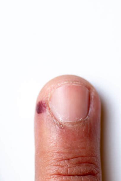 Bumpy Nails 的图像结果