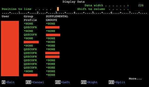 Image result for Debugging ACL Program On IBM IAS 400