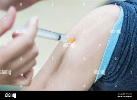 Arm Injection 的图像结果