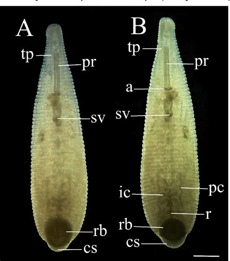 Figure 4 from Biology, morphology and taxonomy of a snail-feeding leech from North Carolina, USA ...
