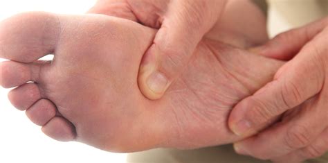 Poor Circulation Leg Sores 的图像结果