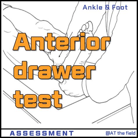 Anterior drawer test / 발목 전방전위 검사/ankle special test/ATFL 손상 검사, 발목 ...