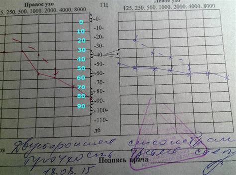инвалидность при тугоухости - Страница 14 - Форум