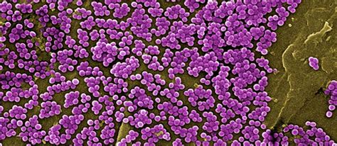 NEW RESEARCH RESHAPES LONG-HELD THEORIES ON BACTERIAL EVOLUTION [1 min ...