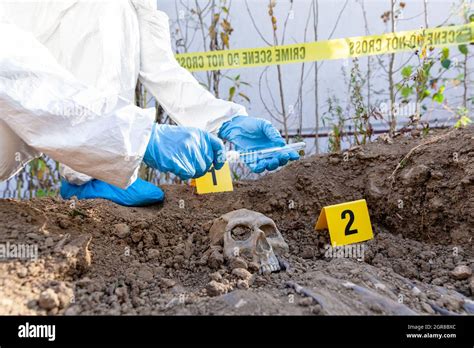 Forensic DNA 的图像结果