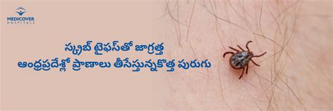 స్క్రబ్ టైఫస్తో జాగ్రత్త - ఆంధ్రప్రదేశ్లో ప్రాణాలు తీసేస్తున్న కొత్త ...