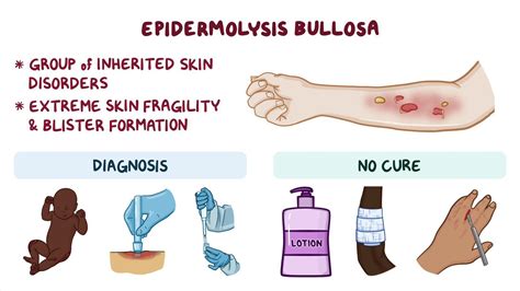 Epidermolysis Bullosa - MEDizzy
