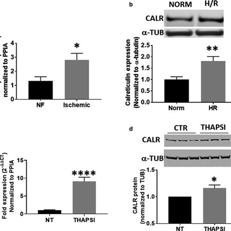 Image result for Reverse Transcriptase PCR