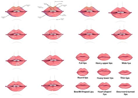 Fundamental Lip Filler Injection Techniques Bundle | Lip Anatomy ...