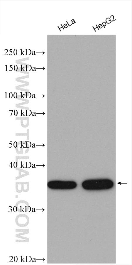 NIFK antibody (12615-1-AP) | Proteintech