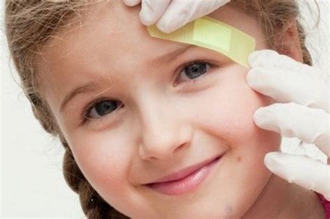 Medidas para curar hematomas y chichones en tus hijos | Revista Cromos