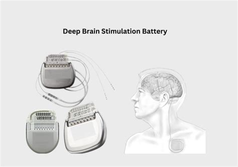 Post-Operative Care After DBS Surgery