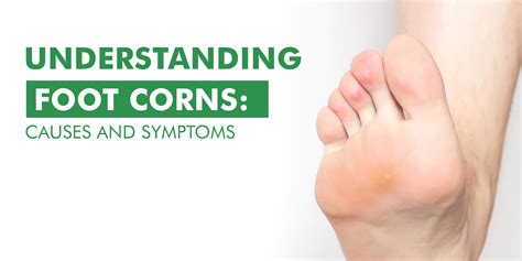 Corn On Foot Diagram Best Sale | emergencydentistry.com