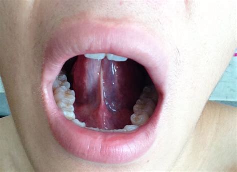 有谁是口腔科医生，这个是不是舌系带过短_百度知道