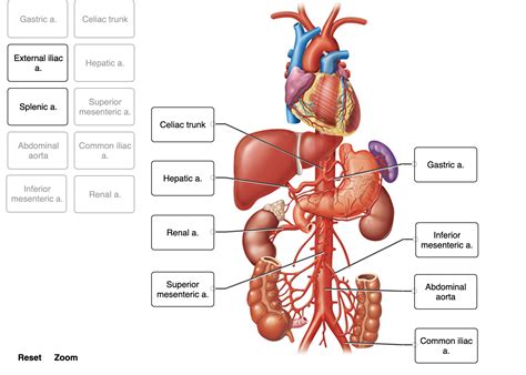 Label the branches of the abdominal aorta. | Chegg.com