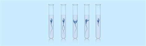 What is Sperm Morphology? Know How Does it Affect Fertility