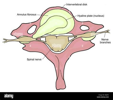Disk Problem 的图像结果