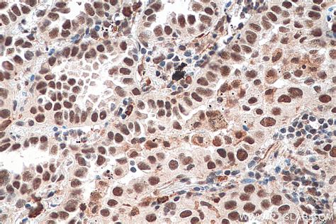 HSF1 antibody (16107-1-AP) | Proteintech