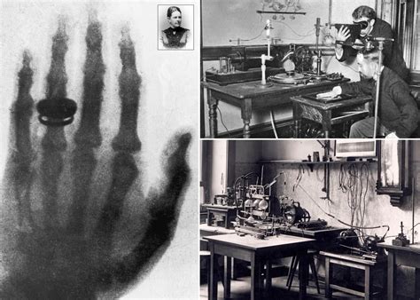 First X Ray Machine Roentgen