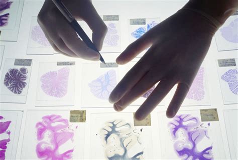 Image result for Brain Tissue Sample