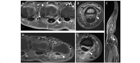 Image result for High-Resolution Hand MRI