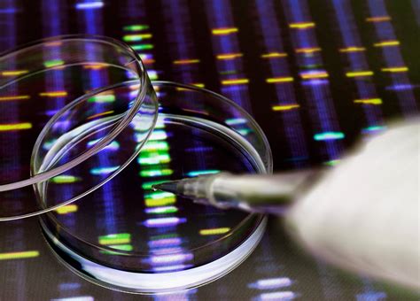 Pharmacogenetics in Antidepressant Selection for Major Depressive Disorder - Psychiatry Advisor