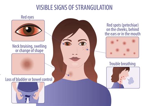 Image result for Strangulation Signs