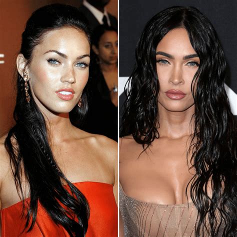 Megan Fox Plastic Surgery Before And After