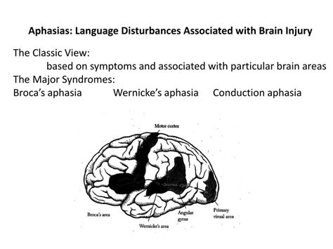 Image result for Conduction Aphasia
