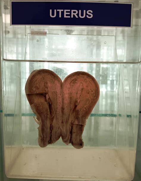 18. UTERUS. | NAMO Medical Education & Research Institute