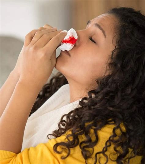 Nosebleeds During Pregnancy: Key Tips For Relief And Prevention