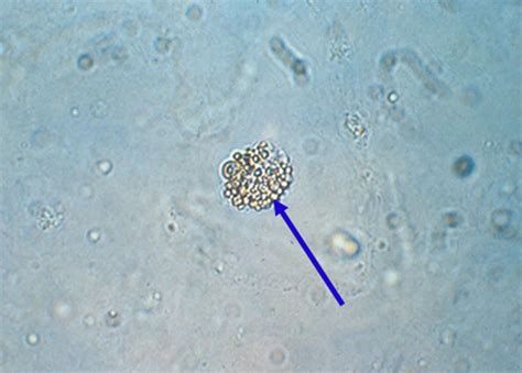 What Are Squamous Epithelial In Urine at Mai Lowder blog