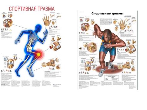 Спортивные травмы. Профилактика - презентация онлайн