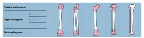 Image result for Fracture Classification System