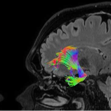 Image result for fMRI Python