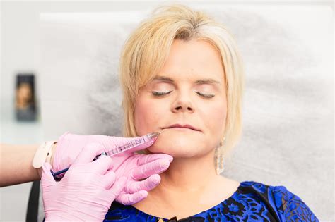Filler in Chicago | Dvida Spa
