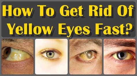 What Does Yellow Eyes Represent at Randall Starkes blog