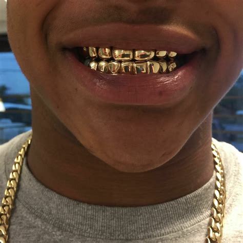 as i am...🎈 | Grillz, Grills teeth, Gold grillz