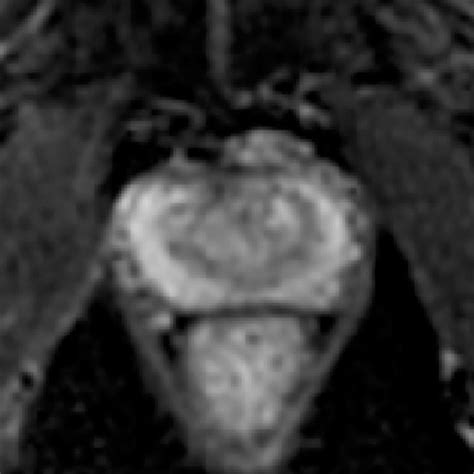 ISMRM 2025 abstracts